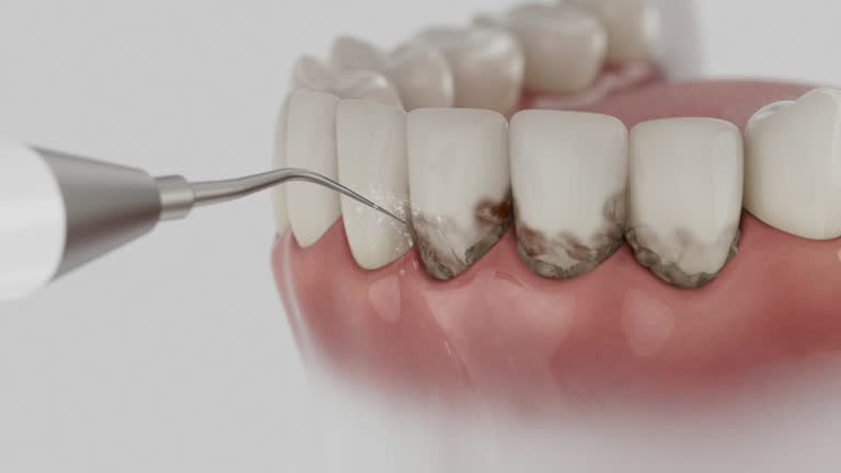 Reliable Dental contractor in Williamsburg, KY by Smile Center Dentistry